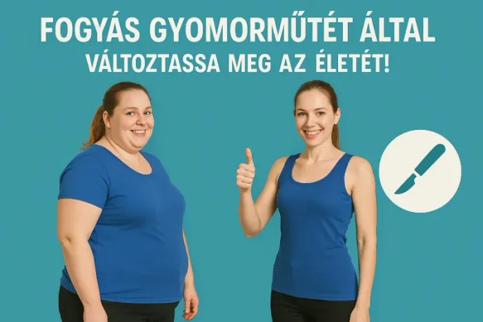 Gyomor bypass hatása a cukorbetegségre: Új kutatások