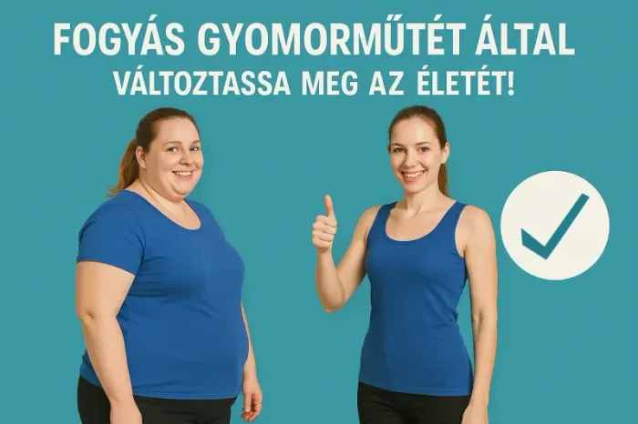 Gyomor műtét utáni mozgás:  edzésterv neked