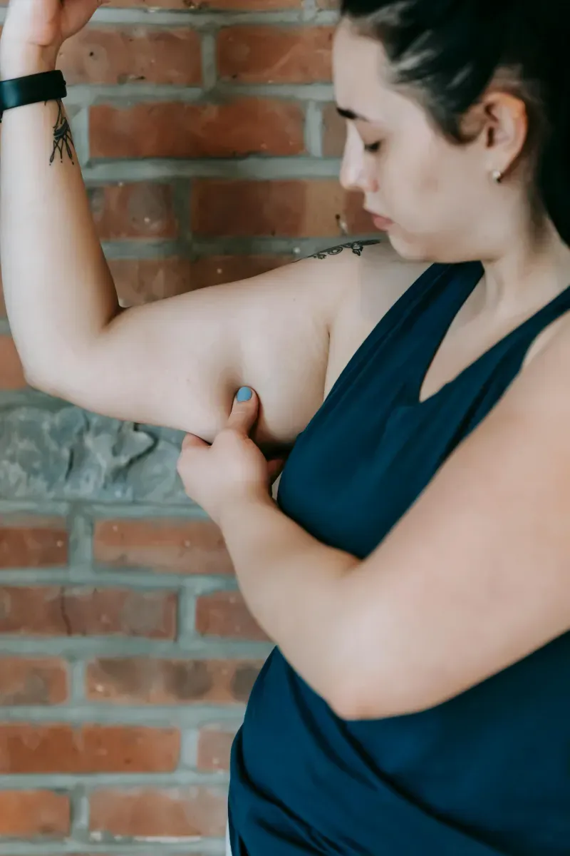 Sleeve műtét vagy bypass? 5 szempont a döntéshez
