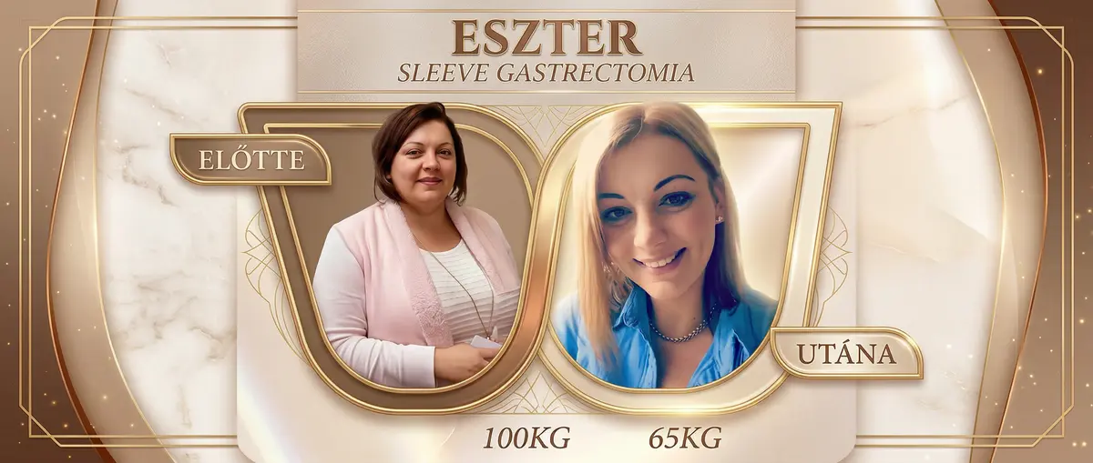 Előtte és utána eredmény